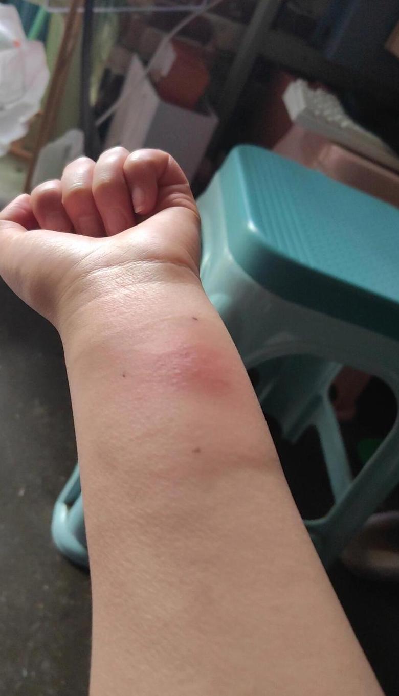 揭秘麸质：过敏真相与应对策略